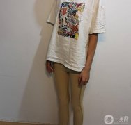 測完我腿脂肪的厚度，做了記錄，然后讓護士帶我下樓體檢