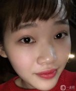 帶著一雙傷心的眼淚，鼻子手術(shù)終于結(jié)束了