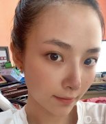 雖然從小到大的朋友都說我長得好看，但我總是對自己的鼻子不滿意