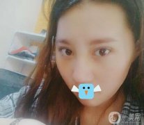 我一直想做鼻子，但是我的鼻子太差了，很難讓它好看