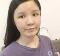 臉部的腫脹正在慢慢減輕，淤青也在消失，越來越正常