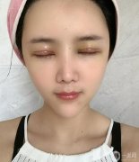 單眼皮可以說(shuō)是很多女生面值里的一大BUG