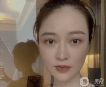 我見到了醫(yī)生，醫(yī)生給我開了外切去眼袋手術(shù)
