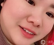牙齒是人體的重要組成部分，整潔潔白可以提升人的整體體質(zhì)，讓微笑時更有感
