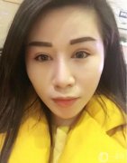 一直想做雙眼皮手術(shù)，但還是猶豫不決，因為這雖然是小手術(shù)，但畢竟還是在臉
