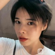 現(xiàn)在可以看到恢復(fù)得相當(dāng)不錯，整個臉真的是越來越有立體感了