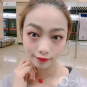 我決定還是去做熱瑪吉了，聽說熱瑪吉這個項目是一個可以刺激臉部膠原蛋白再
