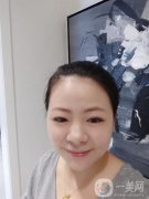 關(guān)于自己的玻尿酸注射手術(shù)過程，其實(shí)內(nèi)心里還是特別開心