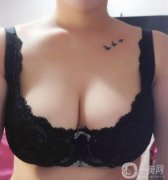 在嚴(yán)重的情況下對女性泌乳后期也有一定的影響，所以副乳切除是重要的