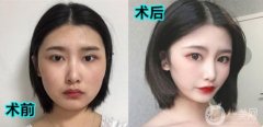 因為我的眼睛不知道為什么看起來那么不在，眼睛的長和寬也不是我想要的