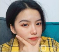 我終于下定決心做雙眼皮了，其實我想了很久，挑了很多醫(yī)院，看了很多案例，