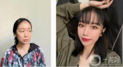 雖然我的眼睛在單眼皮里應(yīng)該比較大，雖然大，但是沒(méi)有層次感