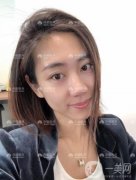 雖然現(xiàn)在做雙眼皮手術(shù)不是什么大手術(shù)，甚至可以說(shuō)十有八九做了雙眼皮