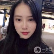 做雙眼皮手術(shù)前，我心里很掙扎，怕沒(méi)有做好反倒毀容了