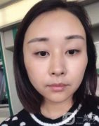 面診時(shí)醫(yī)生說面部凹陷相當(dāng)明顯，尤其是臉頰、太陽穴、額頭