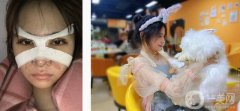 我的鼻子可以說是我擔(dān)心的東西
