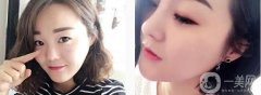 看到那種挺翹的鼻子，感覺特別好看，很立體也很襯臉