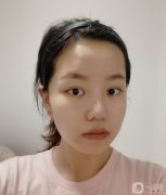鼻子很大，整個(gè)鼻子都很短