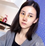 朋友經(jīng)常說(shuō)我的鼻子，說(shuō)我的鼻子好像不發(fā)達(dá)
