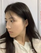 直覺(jué)上，如果缺少鼻梁，就要隆鼻