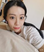 我做線(xiàn)雕的恢復(fù)期很短，別人基本看不到，靜靜的就變美了