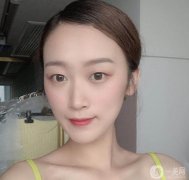 當(dāng)我去打瘦臉針時(shí)，醫(yī)生說我的臉實(shí)際上是多肉的，不是因?yàn)橐Ъ?></a>
                            <div   id=