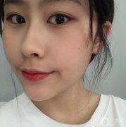 我從小就是肉肉的臉，每次都很煩