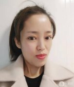 我一直想做雙眼皮手術(shù)，因?yàn)檠劬φ娴暮苡绊懳业拿嬷?></a>
                            <div   id=