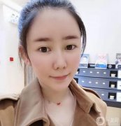 現(xiàn)在臉很自然，填充的部分也很飽滿