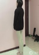手術(shù)前，我了解了很多醫(yī)院和醫(yī)生的抽脂技術(shù)