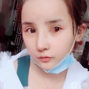 我從小就羨慕別人仰著鼻子，曾經(jīng)想象過如果我有這樣一個仰著的鼻子該有多美