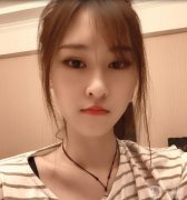 在埋線提升的第15天，到現(xiàn)在為止，感覺效果很好