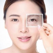 從厭世臉到貓系女，眼睛的美麗與困擾