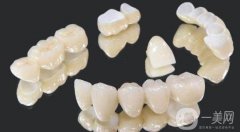 全瓷牙套多少錢一顆價格表2024版，國產(chǎn)和進口品牌的價位范圍對比