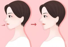 凸嘴焦慮？別再被審美束縛！學(xué)會(huì)這些，讓特色變優(yōu)勢(shì)