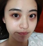 熬夜一時(shí)爽，一直熬夜顏值暴跌！拯救你的肌膚，告別“節(jié)后焦慮”