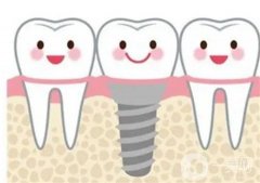 秦皇島種植牙多少錢一顆？價格費用受哪些因素影響？戳這里了解