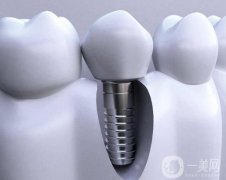 襄陽種牙多少錢一顆啊？種植體品牌+價格介紹，口碑醫(yī)院推薦