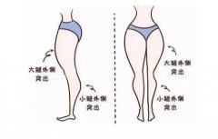 抽脂減肥價格一覽表2024，抽脂減肥安全性一次了解