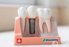 珠海種植牙多少錢一顆？2024珠海便宜又好牙科機(jī)構(gòu)推薦