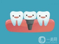 溫州種植牙一顆要多少錢？?jī)r(jià)格收費(fèi)標(biāo)準(zhǔn)/正規(guī)牙科機(jī)構(gòu)一覽
