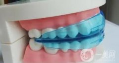 大連牙齒矯正大概要花費多少錢？收費標(biāo)準(zhǔn)+正規(guī)牙科機構(gòu)一覽