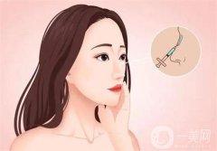 北大深圳醫(yī)院隆鼻案例分享！附崔永言、李天石醫(yī)生專業(yè)擅長一覽