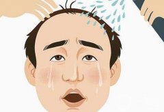 植發(fā)費(fèi)用大揭秘：這些因素讓你不花冤枉錢(qián)！