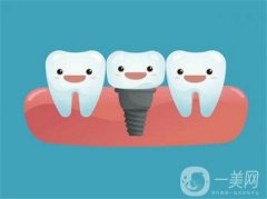 深圳種植牙齒價(jià)目表