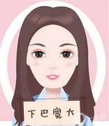 墊下巴的不同方式有哪些優(yōu)點和缺點？