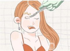 割雙眼皮可能面臨哪些風險
