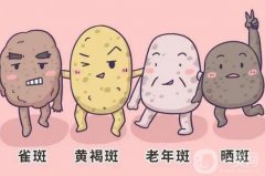 激光祛斑后有哪些禁忌癥