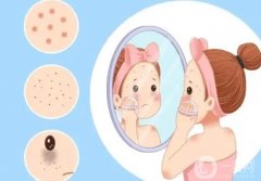 激光祛斑需要幾天才能恢復(fù)