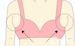 副乳和乳腺增生有什么區(qū)別？